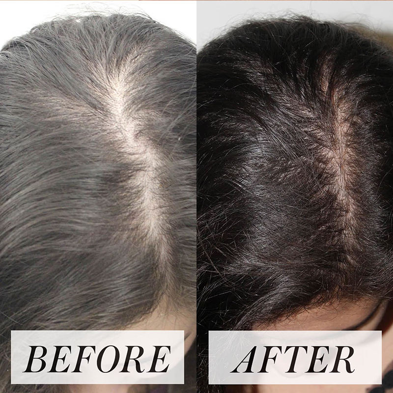 Novexa hair growth oil